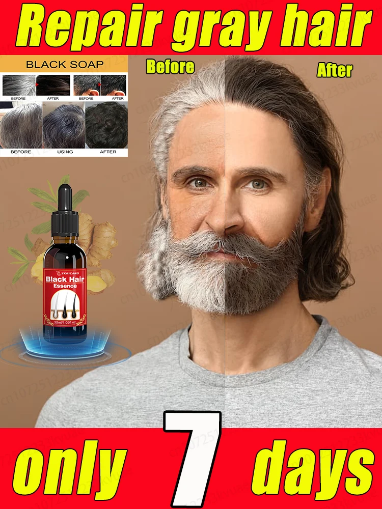 ᴺᵃᵗᵘʳᵃˡ ᴬⁿᵗⁱ⁻ᴳʳᵃʸ ᴴᵃⁱʳ ᔆᵉʳᵘᵐ⠘ ᴿᵉˢᵗᵒʳᵉ ᴰᵃʳᵏ ᴴᵃⁱʳ ᵃⁿᵈ ᴾʳᵉᵛᵉⁿᵗ ᴾʳᵉᵐᵃᵗᵘʳᵉ ᴳʳᵃʸⁱⁿᵍ ⁻ ⱽⁱᵗᵃˡⁱᵗʸ ᶠᵒʳᵐᵘˡᵃ