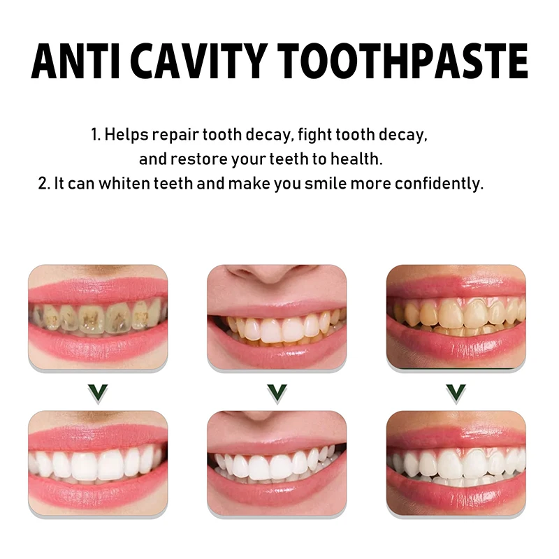 Useful Toothpaste Prevent Repair Tooth Decay Remove Plaque Whiten Teeth Relieve Periodontitis Toothache Freshen Bad Breath