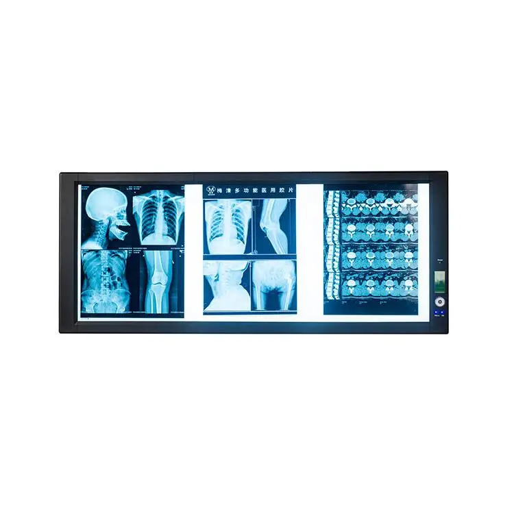 

Hospital Ct Scan Machine X-ray Film Viewer LED Radiography Film Viewer