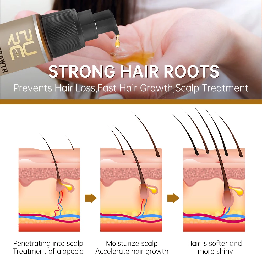 مجموعة شامبو وبيوتين لنمو الشعر والزنجبيل، مضادة لتساقط الشعر، إعادة نمو سريع، يعزز بصيلات فروة الرأس، علاج العناية بالشعر #4