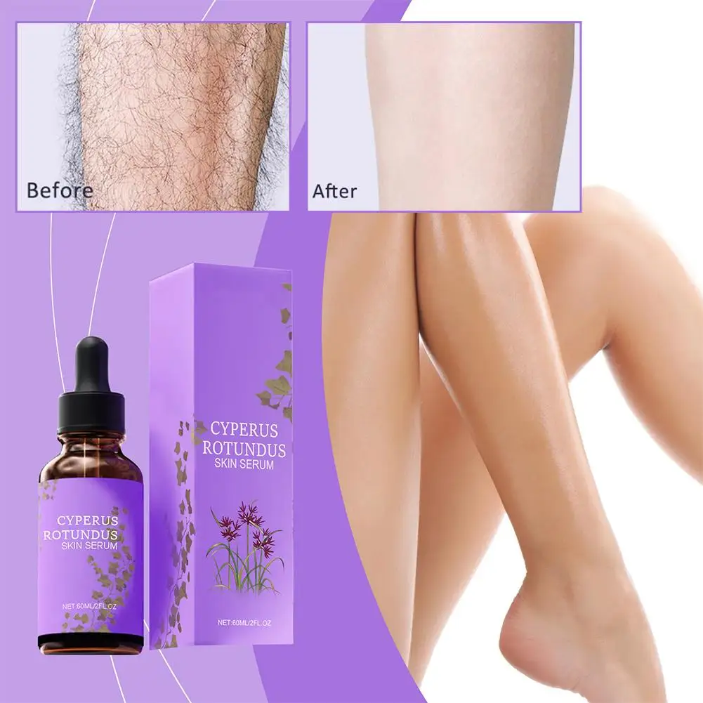 제모 오일 겨드랑이 다리 팔 바디 제모 억제제 매끄러운 바디 피부 제모 오일 ﻿