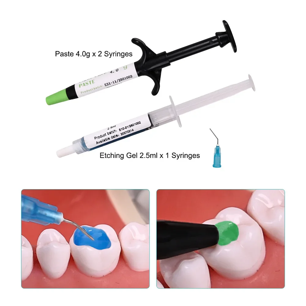 دعامة الأسنان الأخضر الغراء المواد اللاصقة تقويم الأسنان العالمي علاج الضوء لقوس أنبوب السندات لصق محفور حمض هلام طبيب الأسنان المواد