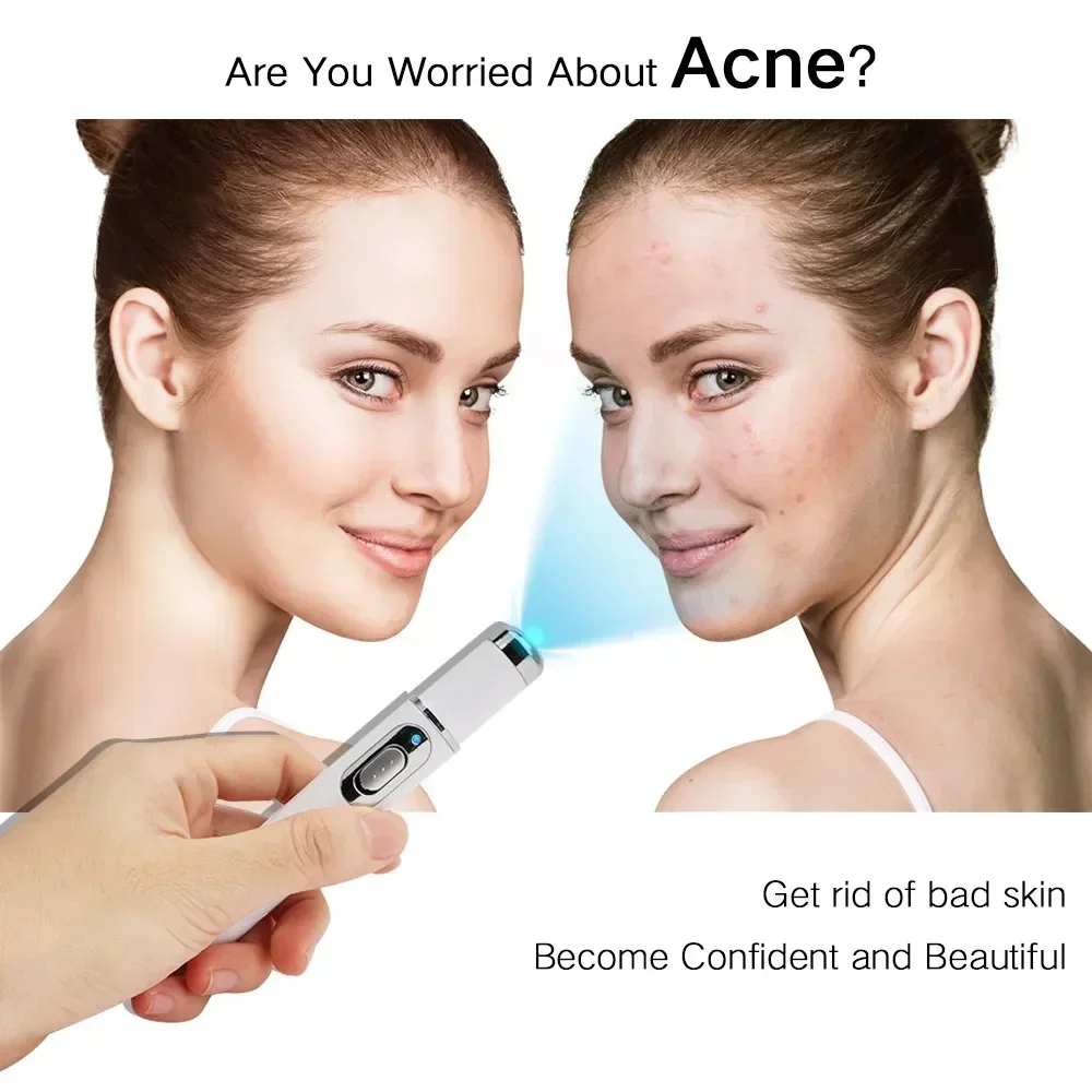 

Осветляющая ручка для кожи с синим светодиодом — правильная пигментация, родины, бирки и бородавки — осветляющее устройство