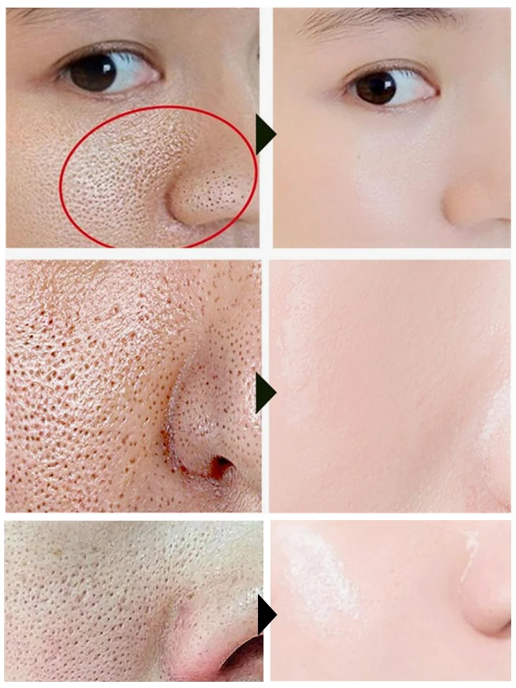 Pore Shrink Face Serum Hyaluronic Acid Moisturizing Lifting Facial Serum ผลิตภัณฑ์ดูแลผิวความงาม