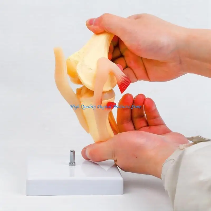 U2JE Anatomical Patella Knee Joint Model With Detailed Muscles Ligaments For Clinical Training and Classroom Demonstration