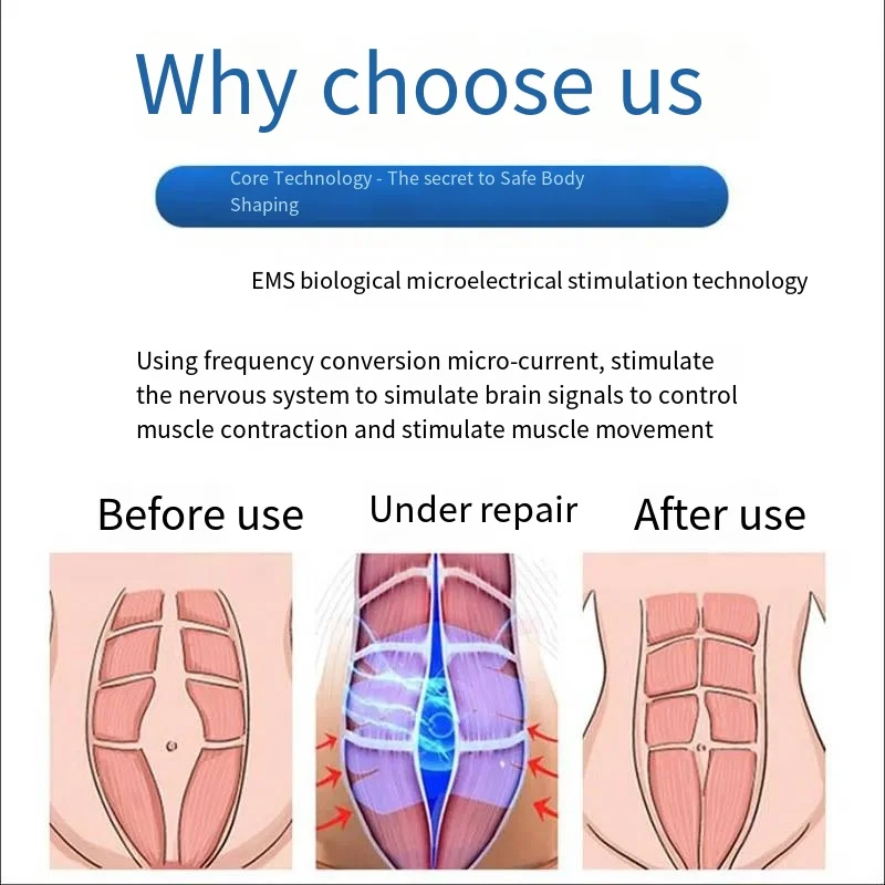 Kegel Trainers for the treatment of urinary incontinence in women Biofeedback electromyography trainers pelvic floor muscle trai