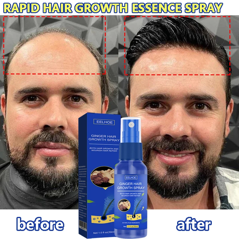 

Ginger Hair Growth Serum Spray Anti Loss Regrowth Hair Growth Oil Essence Scalp Massage Moisturizing Nourish Hair Care Men Women