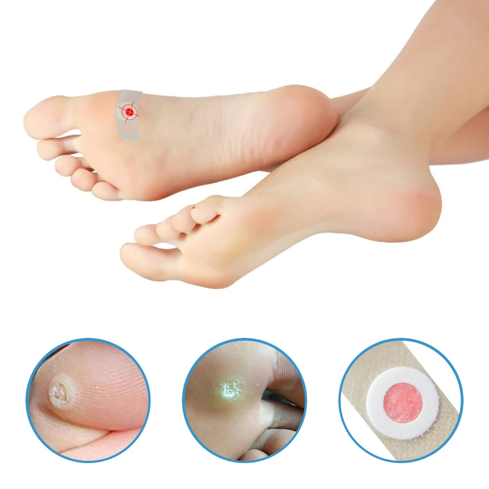 وسادة إزالة الكالس غير المنسوجة ، 42 ، وسادات إزالة الكالس ، عملية ، مفيدة