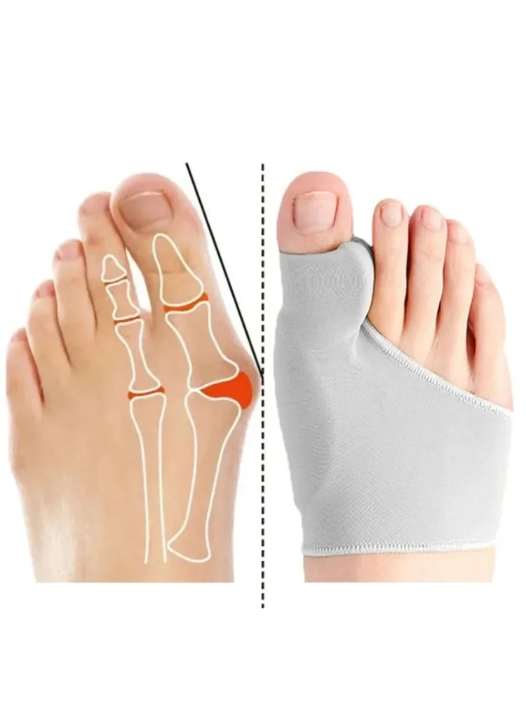 Correcteur d'hallux Valgus, orthèses, séparateur d'orteils, ajusteur de pouce, pédicure, lisseur de chaussettes pour la santé des pieds