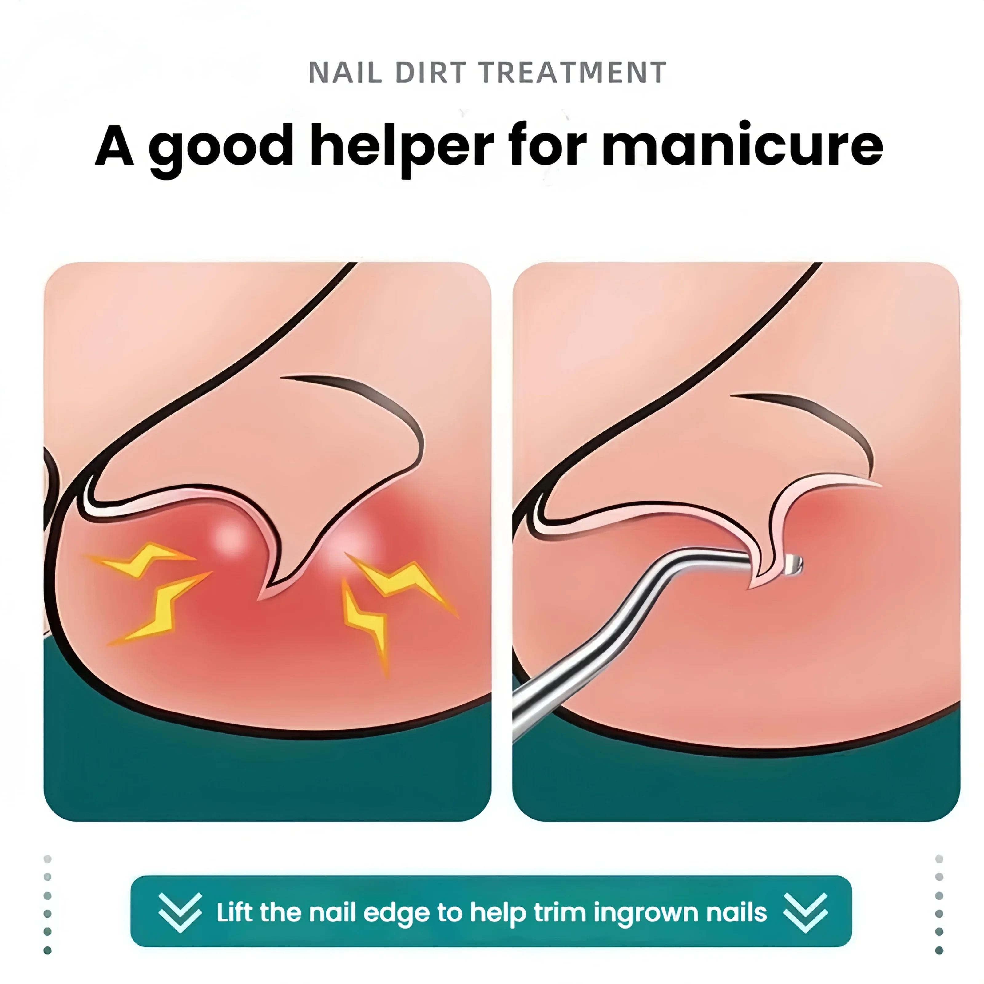 Outils de pédicure professionnels en acier inoxydable, cuillère à rainure incurvée pour nettoyage en profondeur des ongles, lève-ongles incarnés, élimination de la saleté des ongles des pieds