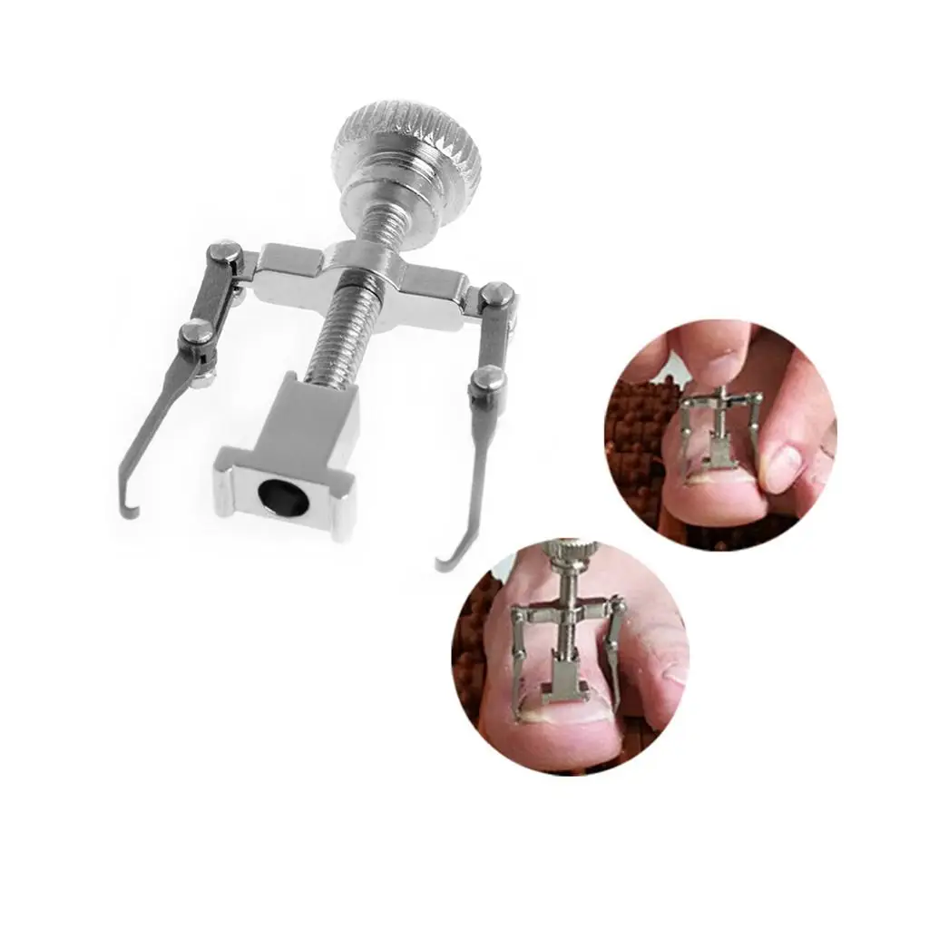 Foot Nail Orthotic Ingrown Toenail Recover Device Pedicure Treatment Tool for Home Personal Care