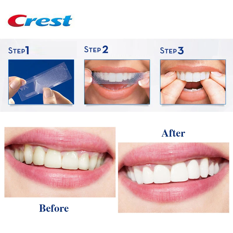 Crest 3D Glamorous Whitestrips - Professional Effects teeth whitening Dental White Kit 30 Minutes White Teeth no Pain