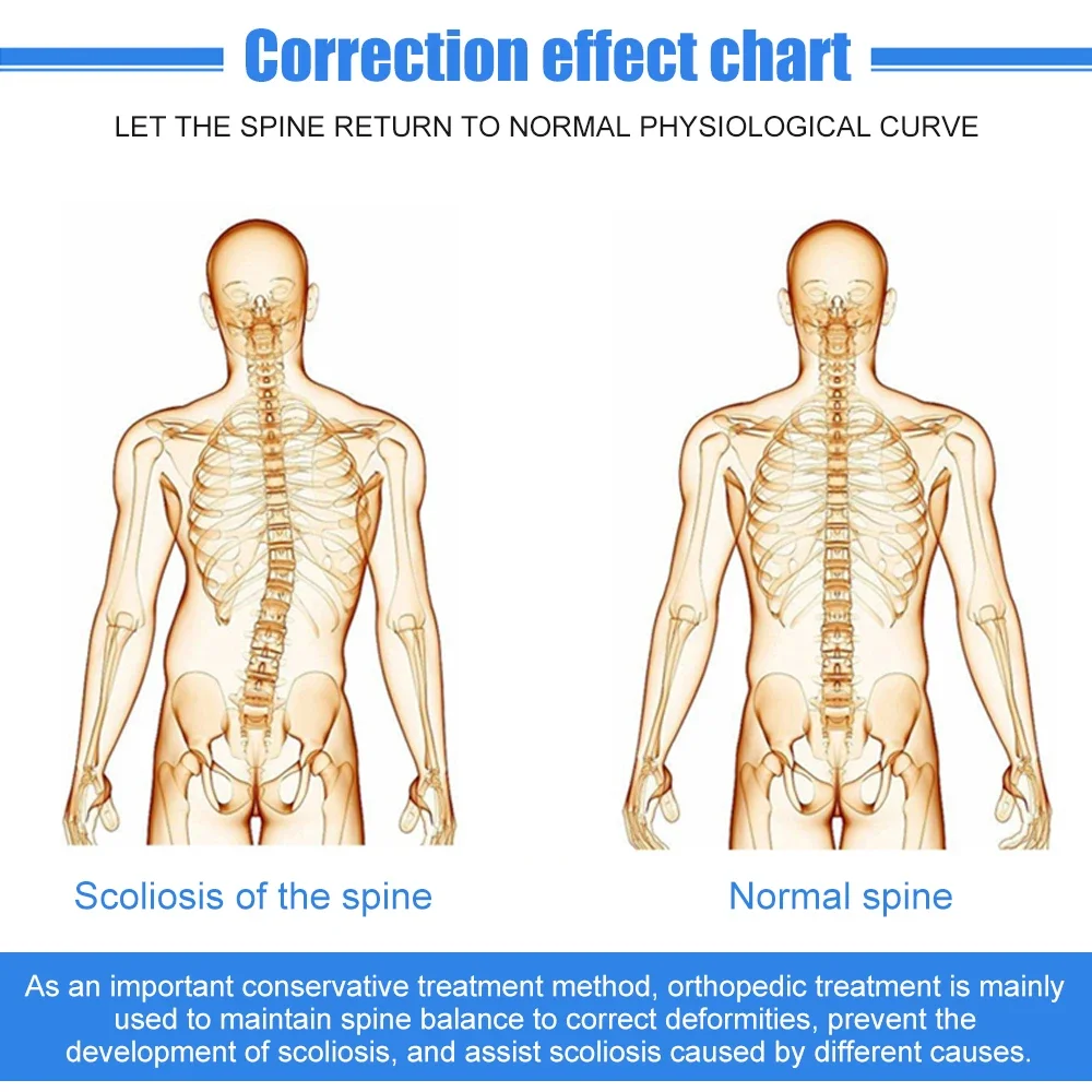 1Set Scoliosis Braces Posture Strainghter Treatment Adjustable Spinal Auxiliary Orthosis for Back Postoperative Recovery Adults