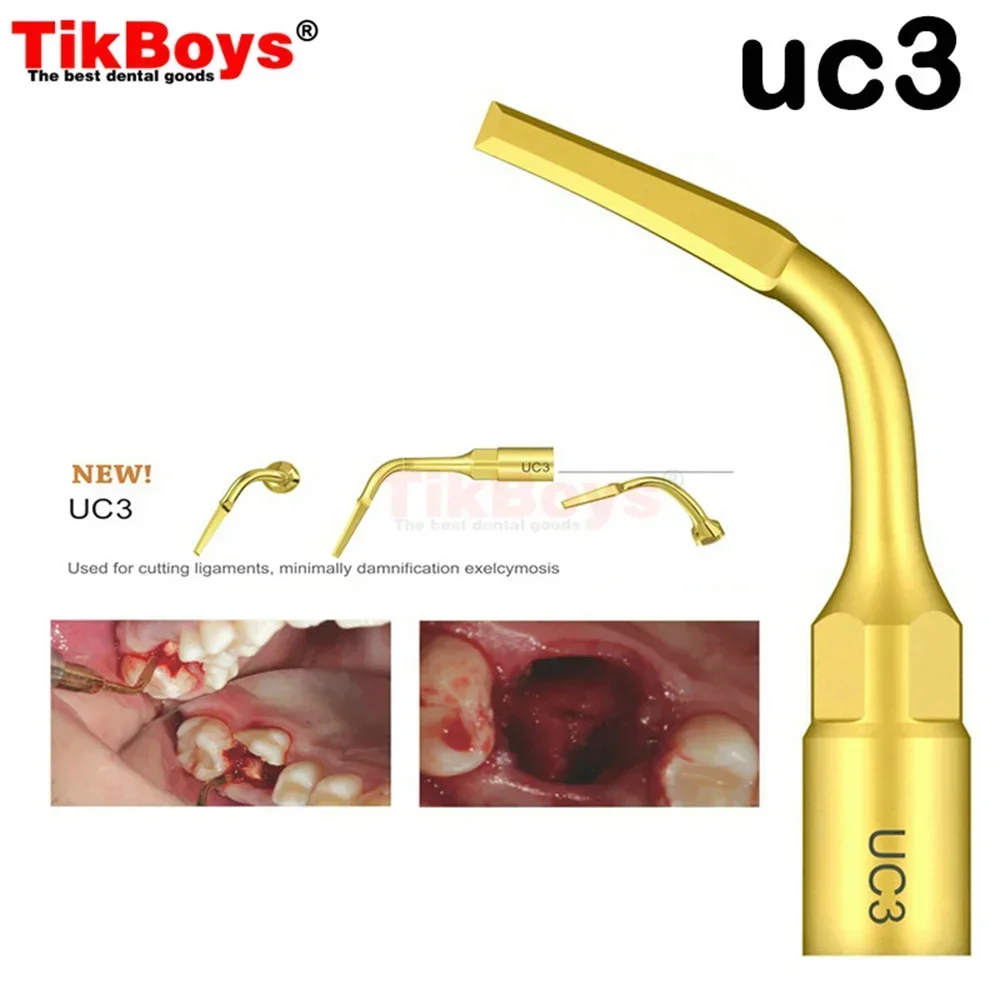 Escalador de extracción ultrasónico Dental UC1 UC2 UC3, punta de pieza de mano, punta de escalado para Mectron, herramientas de fracción de raíz de ankylosis