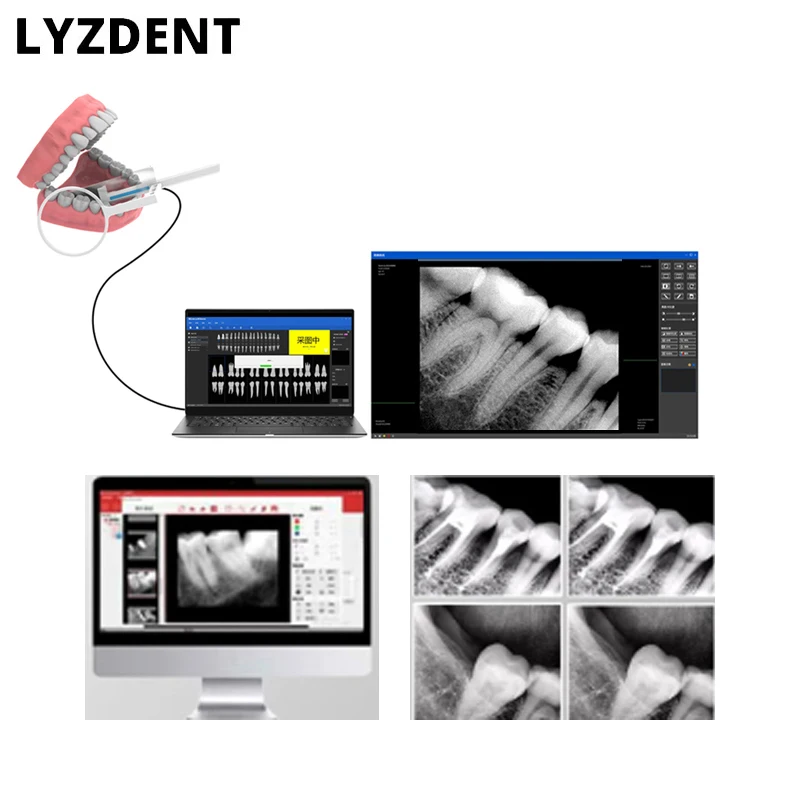 Dental Dentistry Digital Cameras Sensor X-Ray High-Frequency Rx Digital Intraoral Digital System H D Image Radiovisografo Tools