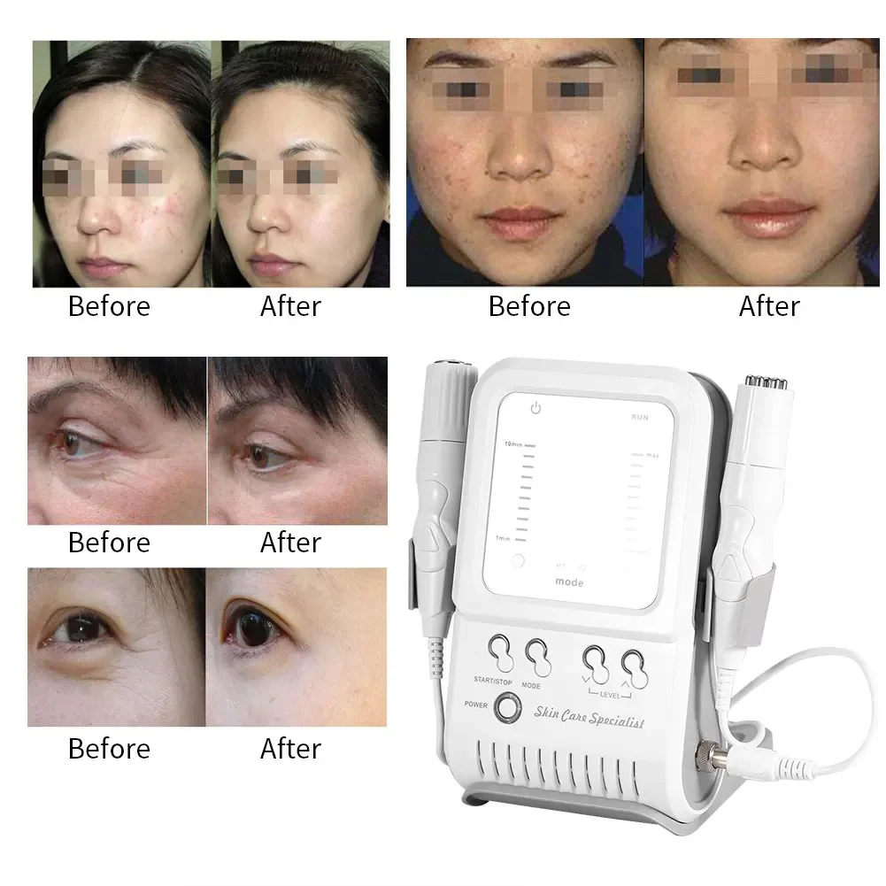 New Useful 2In1 RF No-Needle Massager Quality ABS Skin Face Lift Firming Radio Frequency Facial Skin Rejuvenation Beauty Machine