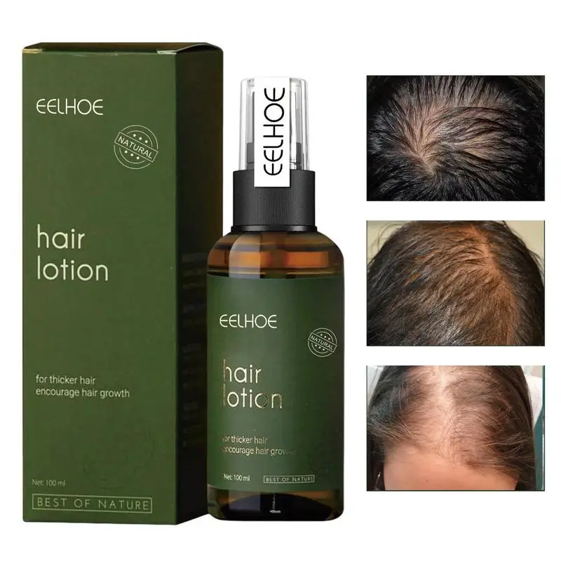 

Fast Hair Growth Oil Nourishing Growth Hair Treat- Ment Anti Hair Loss Men Women Scalp Fast Nourish Scalp Hair Care Product