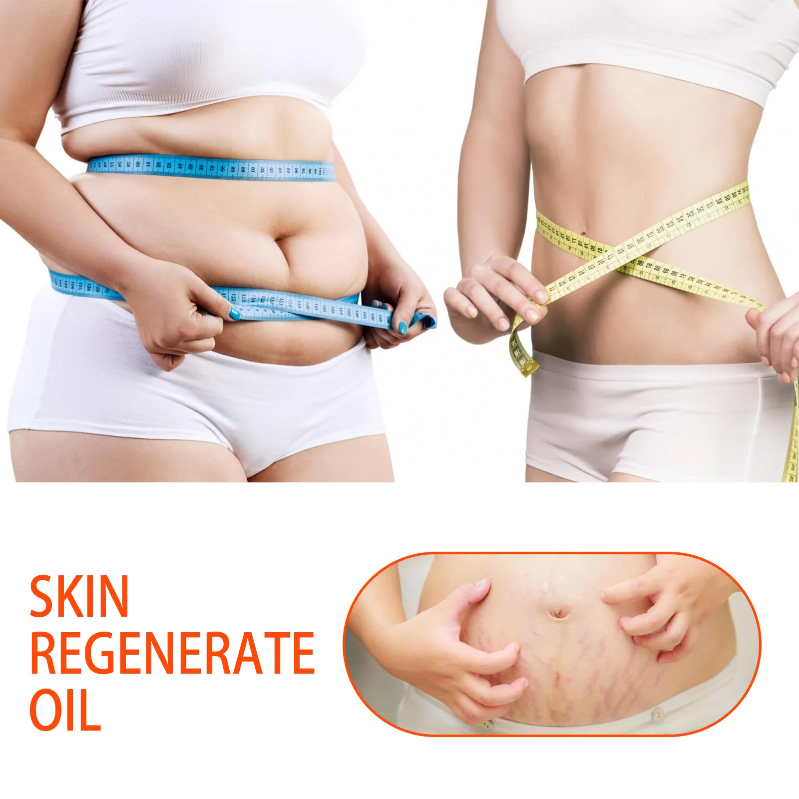 Skin Regenerate Oil Stretch Mark+ Scars Natural Skincare Oil, Enhance Skin Elasticity, Deeply Nourishing and Moisturizing, 125ml