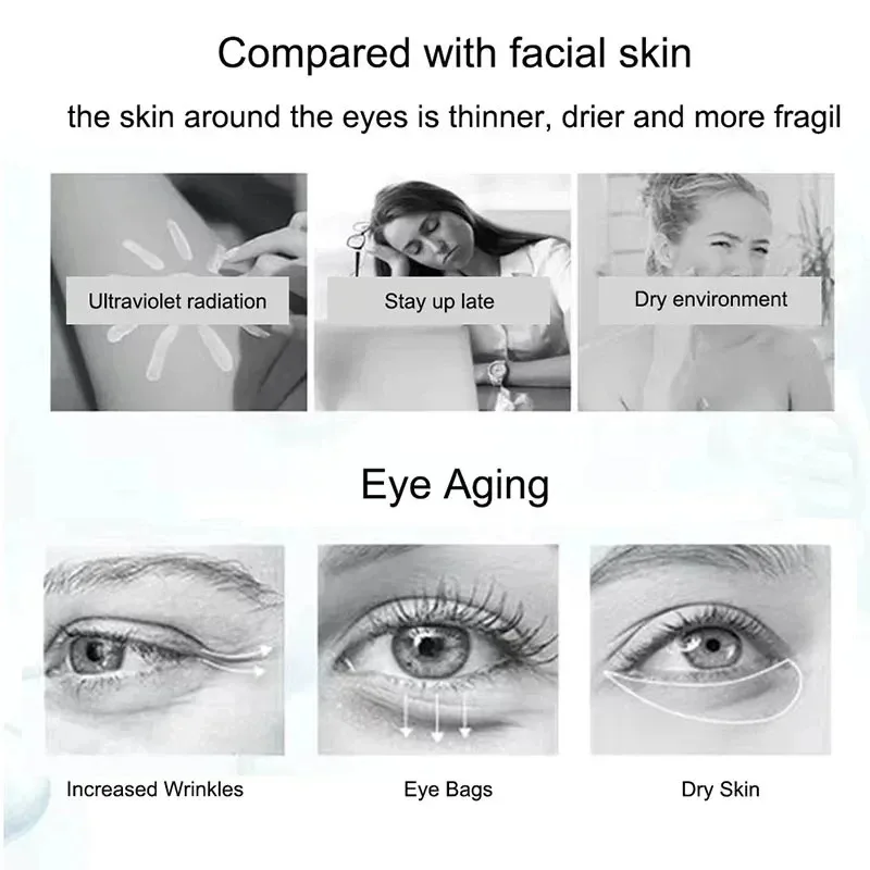 Nicotinamide Eyes Cream Dark Circles Remove Eye Bags Under Eye Hyaluronic Acid Moisturizing Serum Against Puffiness Eye Care Gel