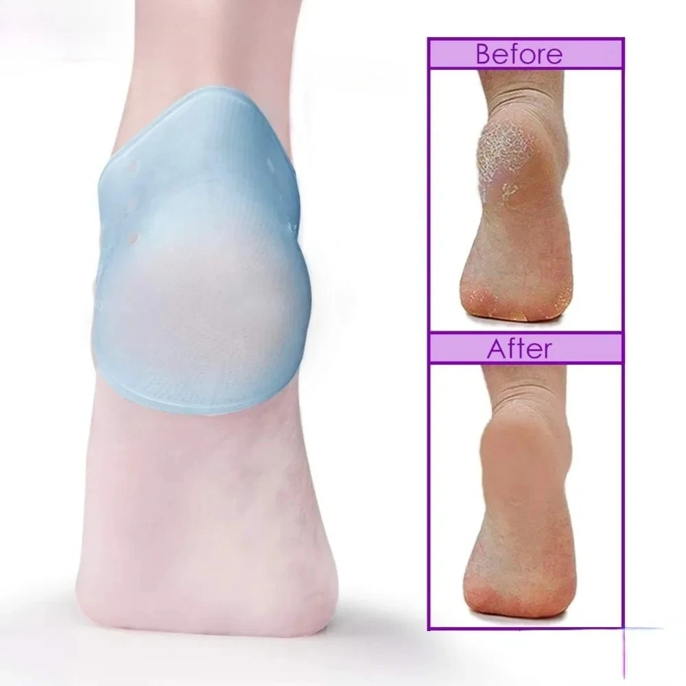 2 قطعة وسادة كعب هلام كعب حامي لالتهاب اللفافة الأخمصية أخيل التهاب الأوتار العظام حفز المؤلم قدم تخفيف الألم أدوات باديكير