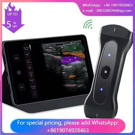 Wireless Handheld Ultrasound Scanner MSK Musculoskeletal Orthopedics Sports Medicine Nerve Block Guidance