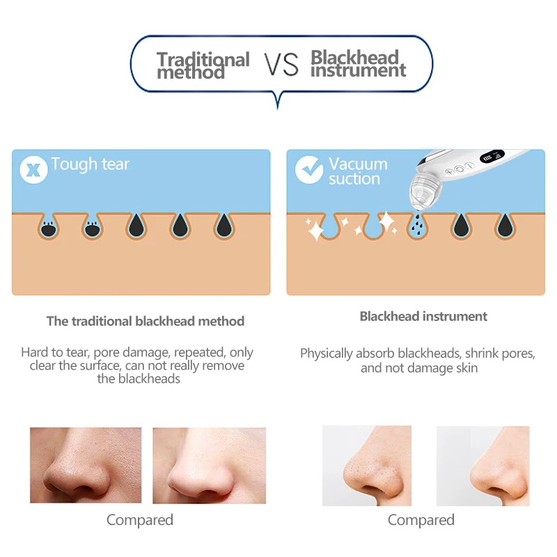Elettrico per la rimozione dei punti neri Acne del viso Aspirapolvere Pore Adsorber Pulizia profonda dei pori Ricaricabile Strumento di bellezza per la cura della pelle