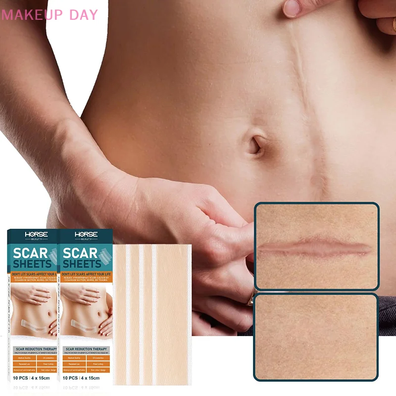 10Pcs Silicone Gel Scar Sheet Patch Treatment Removal Tape Acne Trauma Burn Scar Cover Skin Repair Section Ear Beauty