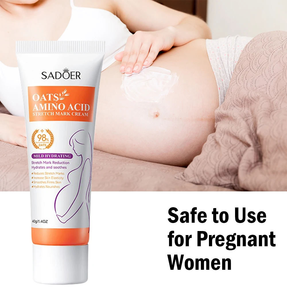 Removes Stretch Mark Cream To Remove Postpartum Obesity Pregnant Women Repair Anti-Aging Winkles Firming Body Cream Skin Care