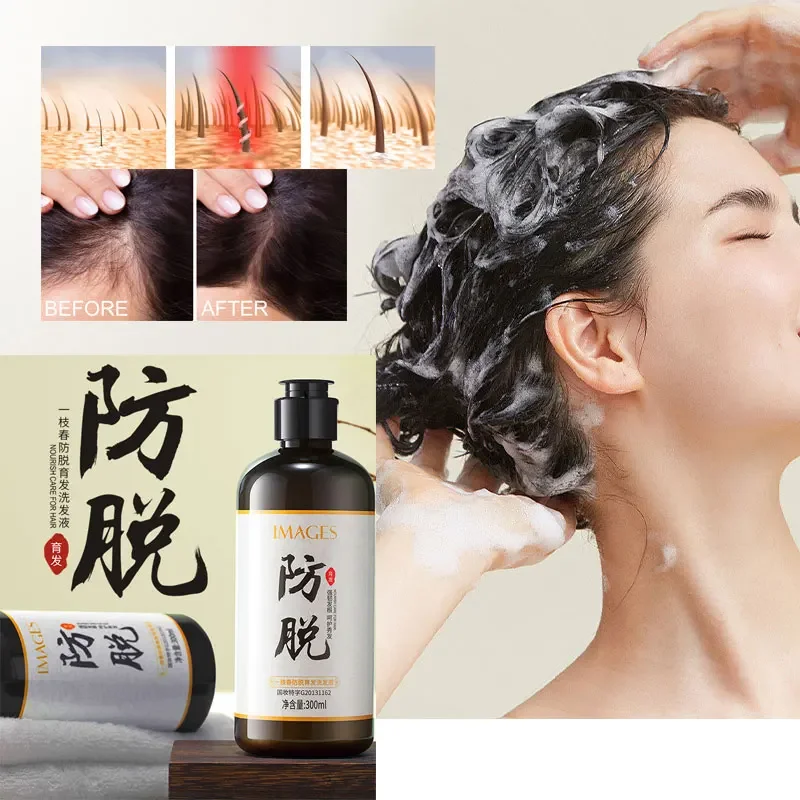 

Шампунь для роста волос, перхоть, уход за волосами, имбирный шампунь Ginger Shampoo Polygonum Multiflorum Tea Seed Saponins, освежающий контроль жирности