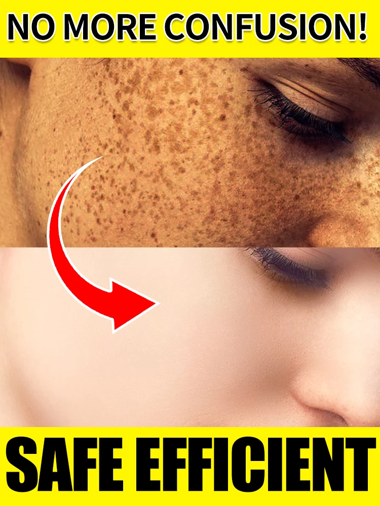 

Effectively lightens dark spots and restores facial skin