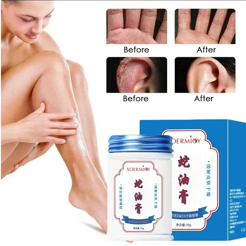 Herbal Anti Crack Foot Cream, Heel Cracking Repair Products, Esfoliação Dead Skin Removal, Suavização Hidratar, Smooth Skincare