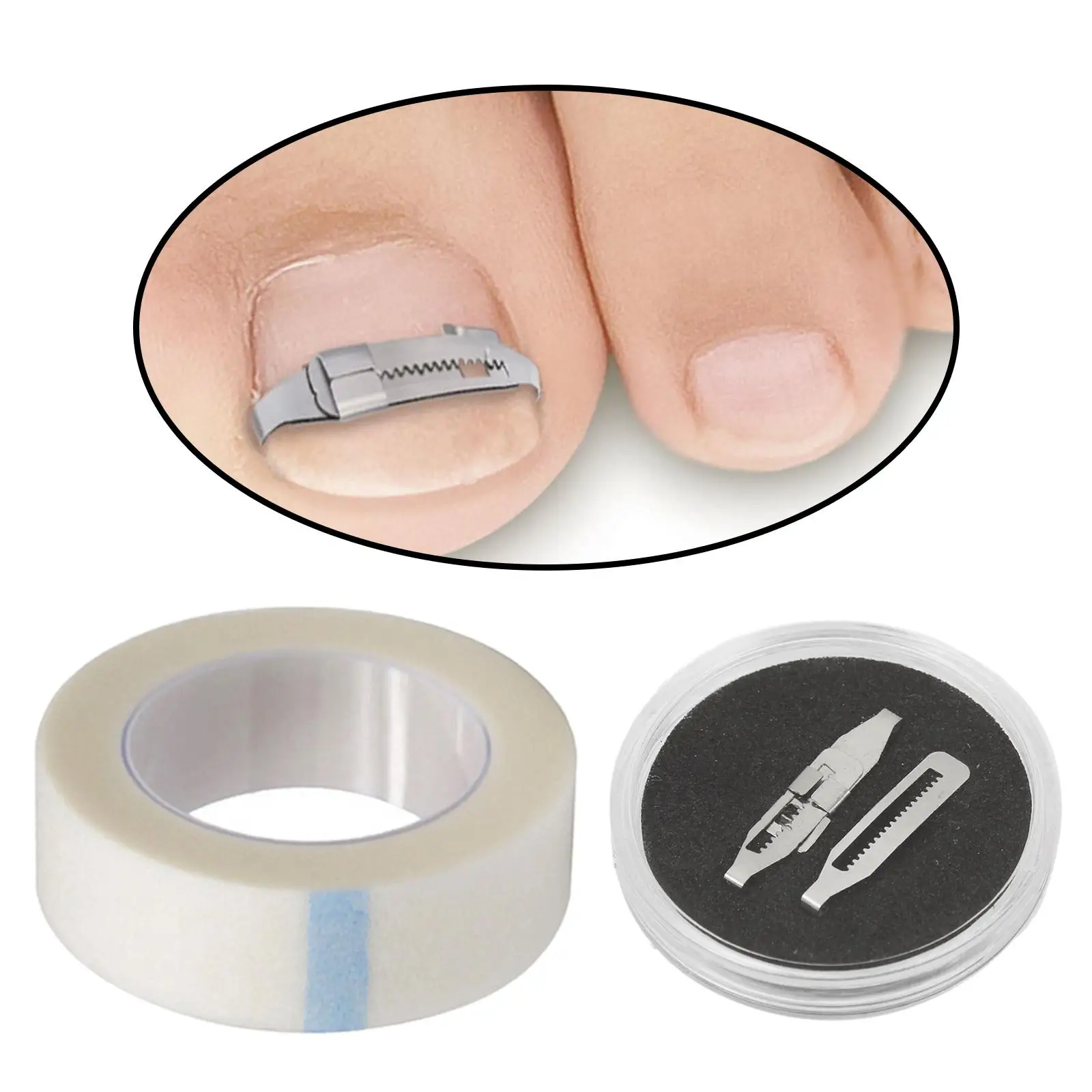 4xIngrown Toenail Treatment Ingrowing Corrector ペディキュアツール フットケアセット D