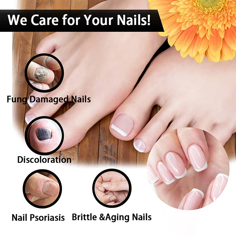 Nail Fungals Renewal Nail Repair Liquid for Discolored Thickened Crumbled Nails Nail Fungals for Discolored Broken Cracked