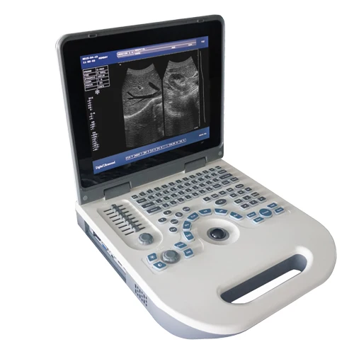 Wholesale Customized Good Quality Mini Machine Laptop Veterinary Ultrasound Portable