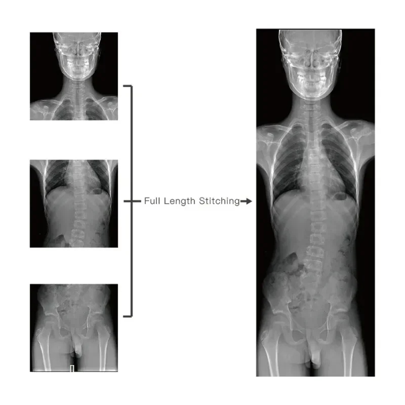 رائجة البيع الطبية الساخنة عالية التردد آلة الأشعة السينية المتنقلة المحمولة نظام التصوير السريع DR