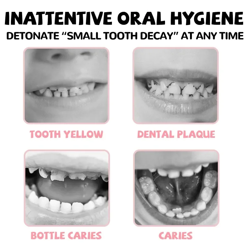 สเปรย์ฟันขาวโปรไบโอติกสำหรับเด็กสูตรธรรมชาติทำความสะอาดปากเพื่อสุขภาพฟันที่ดียาสีฟันดูแลฟันสำหรับเด็ก