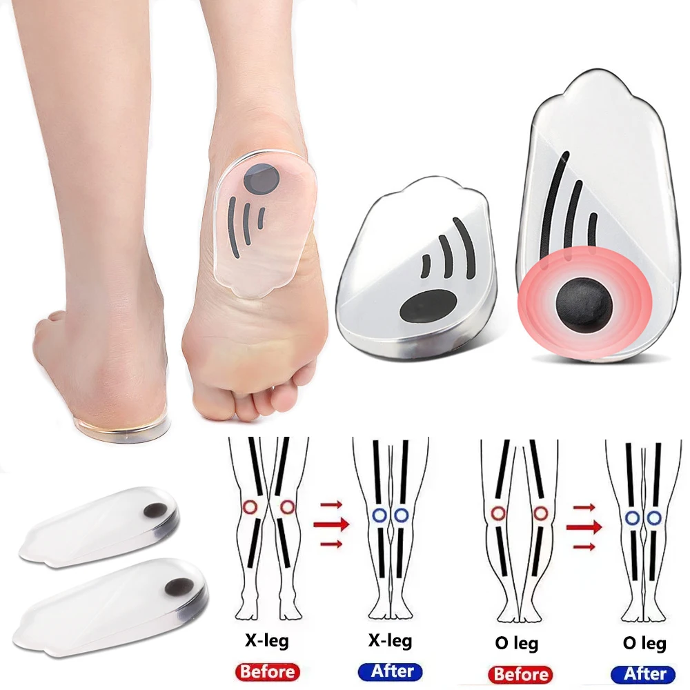 Magnetische orthopädische Silikon-Einlegesohlen für Schuhe, Männer und Frauen, Plantarfasziitis-Entlastung, O/X-Beine, Knie, Varus-Korrektur, Füße, Fersenpolster – Detail 1