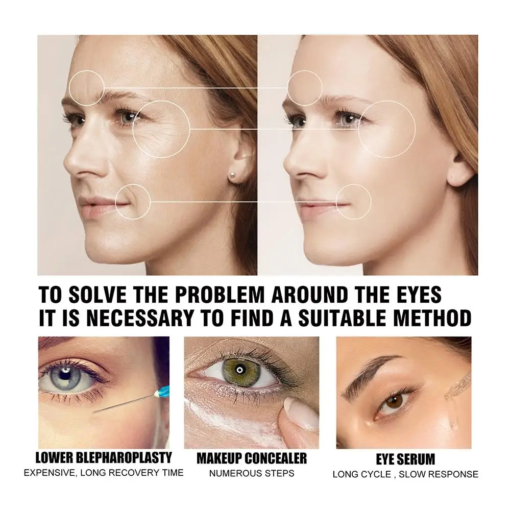1/2/3/5 SZT. Celyn 3-minutowy krem pod oczy liftingujący, ujędrniający, łagodzący worki pod oczami i cienie, nawilżający krem pod oczy z peptydami