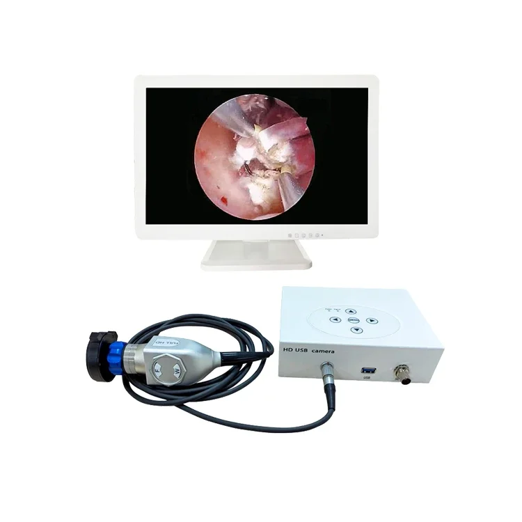 medical HD portable usb smallest endoscope camera for ent