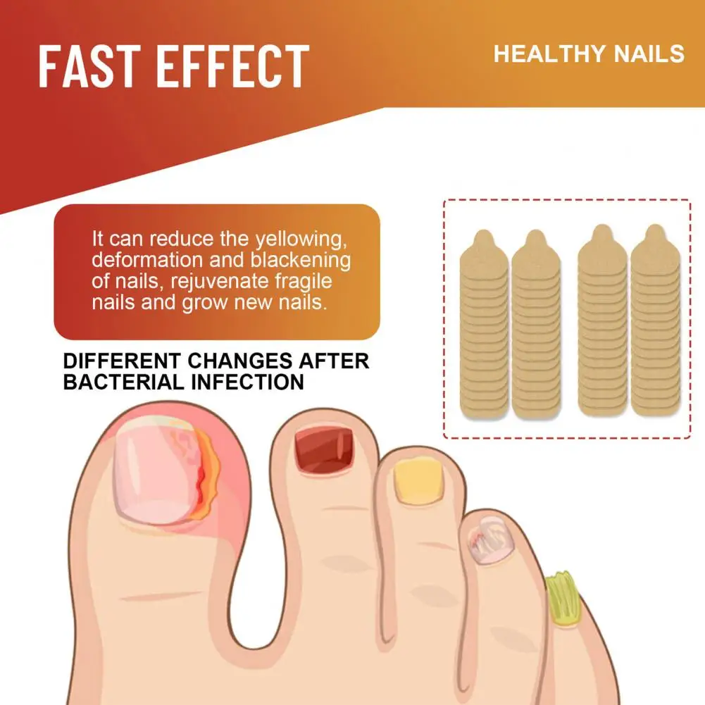 Nail Treatment Nail Fungus Relief Patches for Toe Care Gentle Treatment for Nail Appearance Strengthening Nails at Night Fungus