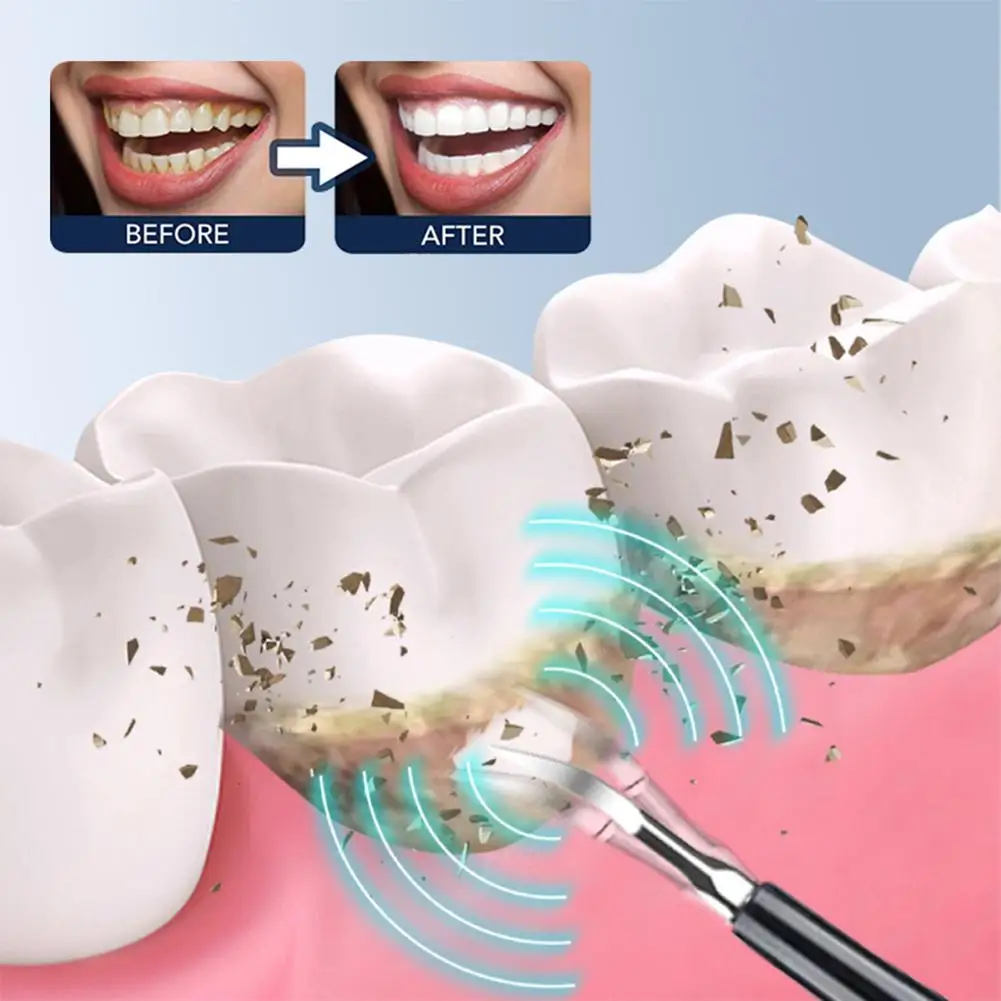 قشارة أسنان بالموجات فوق الصوتية ، مزيل الجير ، فرشاة أسنان كهربائية ، منظف لوحة الأسنان الصوتية ، 6 في 1