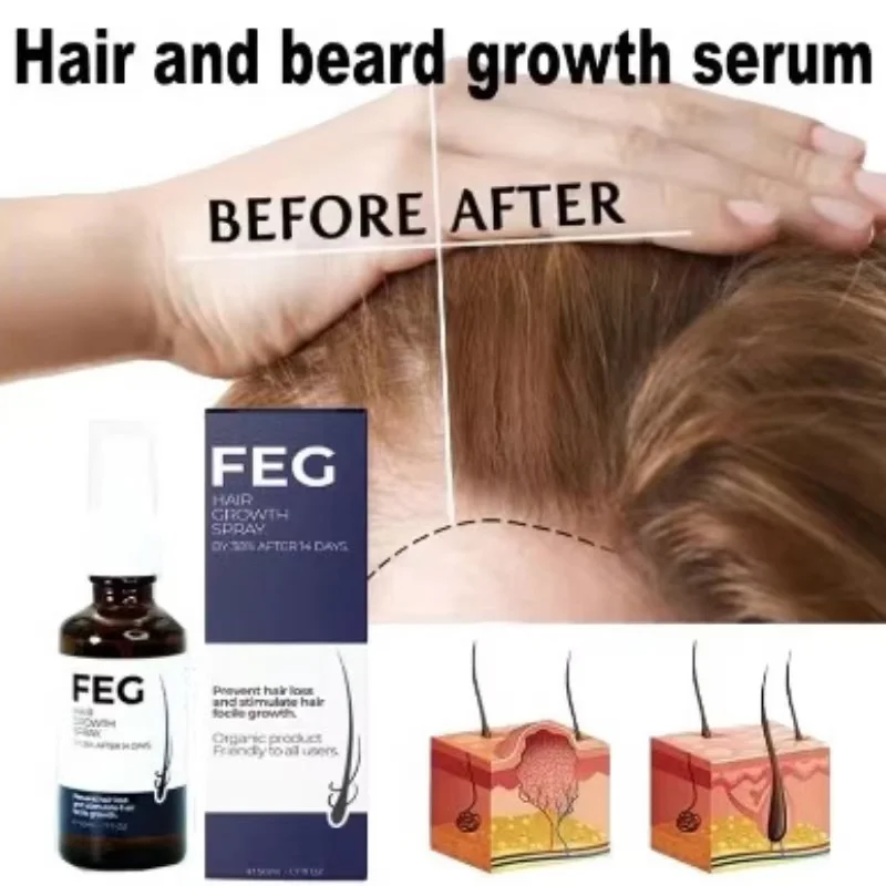 FEG Hair Growth Spray Advanced Formula Rapid and Effective Scalp Care Hair Strengthening Revitalizing Salon-QualityBattle