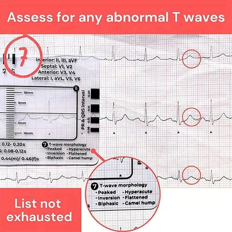 ECG 7 Step Ruler,ECG 7 Step Ruler For ECG/EKG Interpretation,ECG Reference Guide Ruler,EKG Calipers Measuring Tool