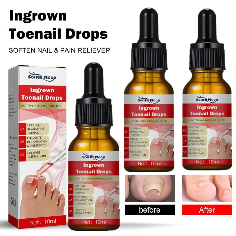 

3/2/1pcs Ingrown Toenail Treatment Serum Nail Correction Recover Oil Pain Reliever Nail Softener Trim With Ease Oil Feet Health