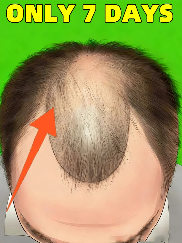 

suitable for hair growth assembly,liquid guide comb,massager massage tool,Hot Sale,Applicator,hair scalp massager，Free shipping