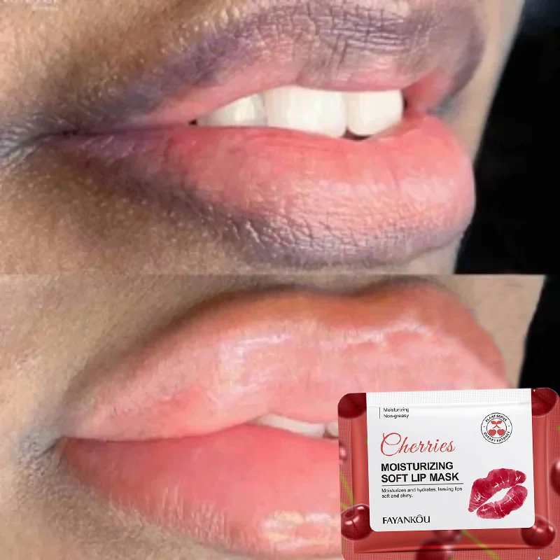 Lip Membraan Verwijderen Donker Lichter Melanine Lipmasker Fade Lip Lijn Fleuren Exfoliërende Hydraterende Dode Huid Herstel Lipverzorging Nieuw