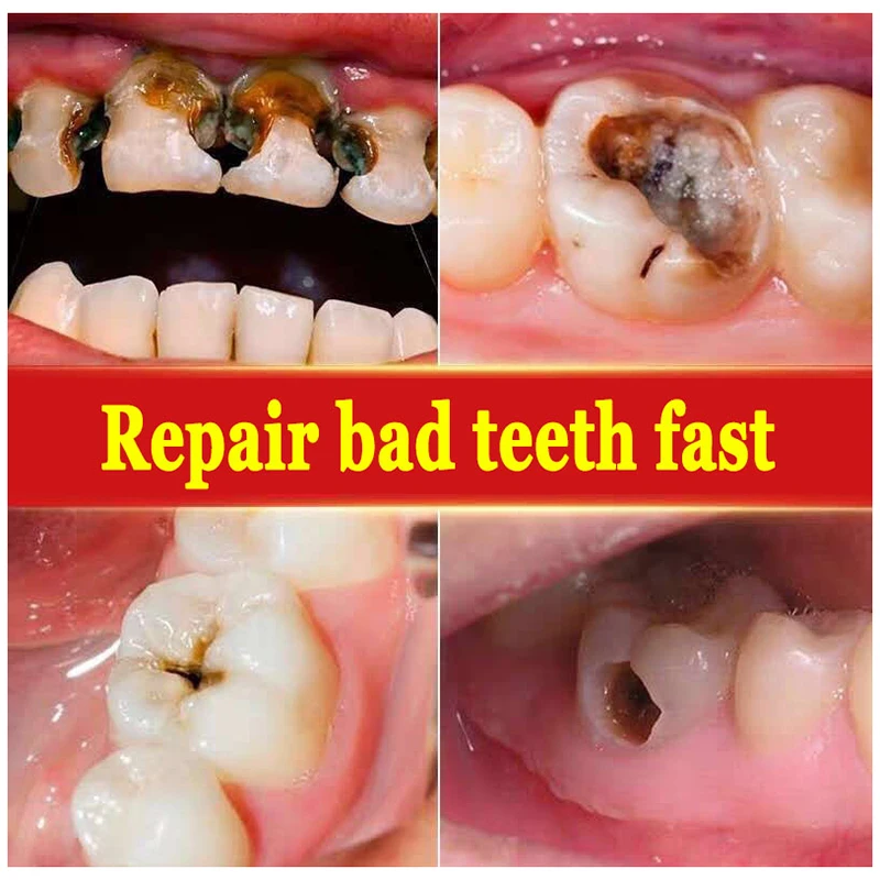 Probiotic Whitening Toothpaste Cleaning Teeth Repair Cavities Caries Removal Plaque Yellow Stain Oral Fresh Breath Gum Care