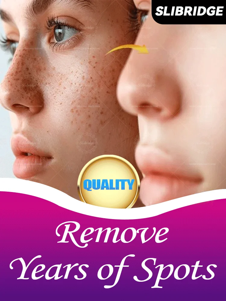 Kostenloser Versand Gesichtspflege-Tools, schnelle Hautaufhellung, lösen Melasma, dunkle Flecken, geeignet für alle Altersgruppen