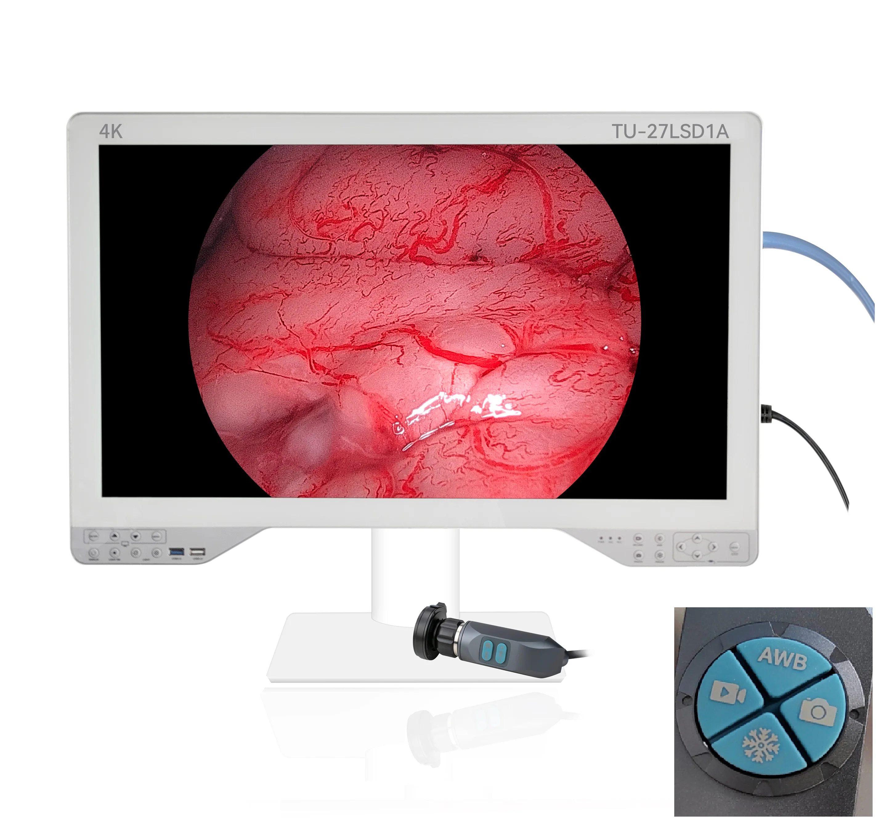 27inch Medical Grade 3 in 1 4K FHD Arthroscopic Endoscope Camera