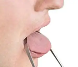 

Surgical Grade Stainless Steel Tongue Scraper for Adults Professional Bad Breath Removal Dental Tongue Cleaner